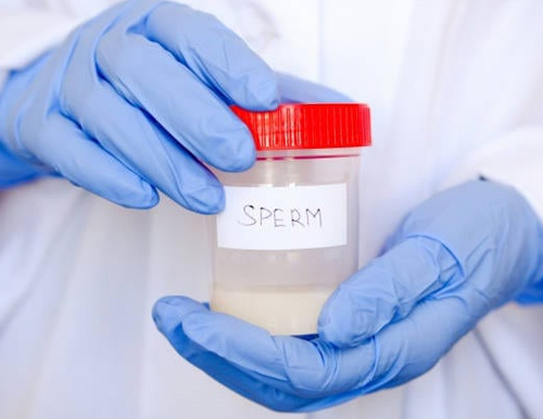Semen Analysis Test Centre
